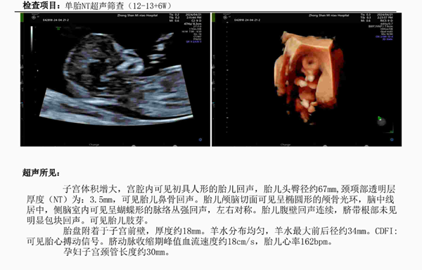 “我这么好的胚胎，为什么不要我？”32岁妈妈的试管破局记