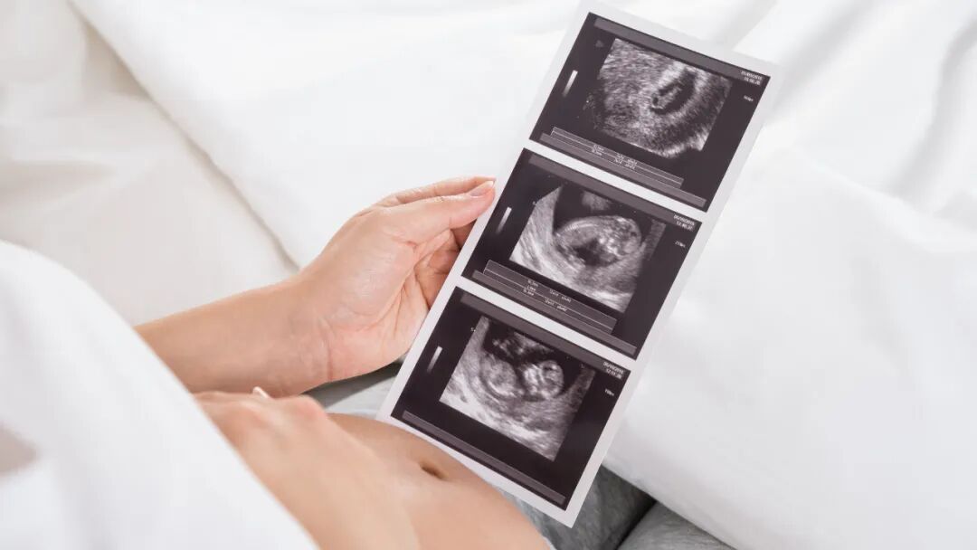 验出怀孕反而更害怕？一个26岁女孩的4次“假怀孕”