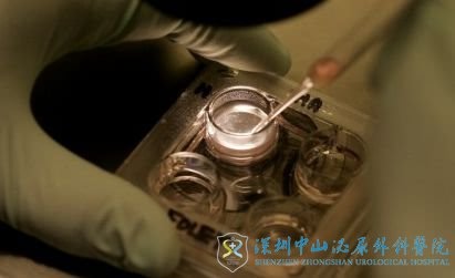 第一代试管婴儿