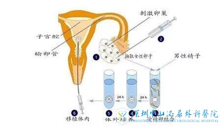 试管婴儿生长激素
