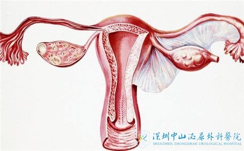 输卵管不通可能会诱发宫外孕