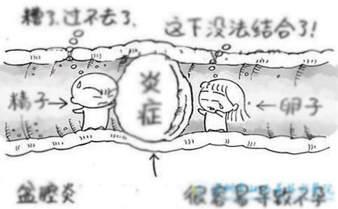 多囊卵巢难治吗