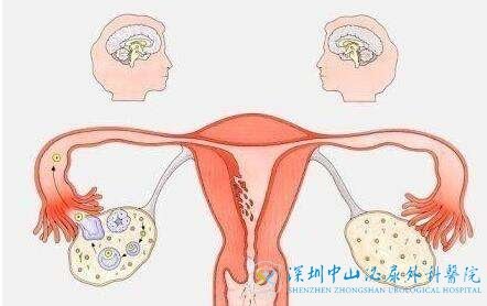 得了多囊还能自然受孕吗