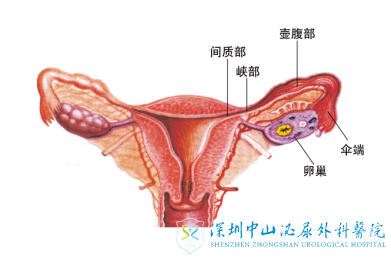 输卵管若粘连了还会怀孕吗
