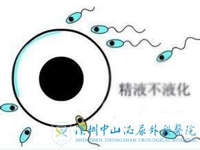 男性精子不液化怎么做试管呢
