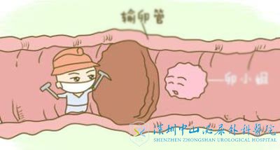 输卵管做了介入还是不通怎么办还能进行试管治疗吗