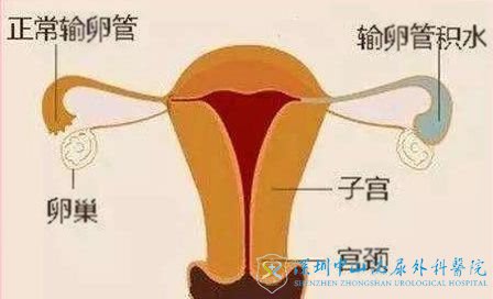 ѹճǰڵ֢״ʲôԹӰ