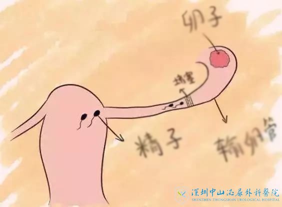 输卵管左边通畅右边通而不畅能做试管吗