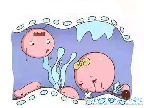 试管婴儿移植之前需注意:小心输卵管积液