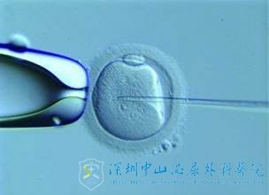 是什么情况下需要做二代试管婴儿呢