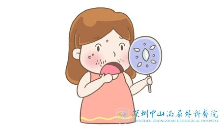 多囊卵巢综合征