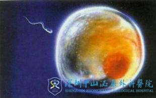 性欲低下会影响正常生育吗,还能选择试管婴儿生娃吗