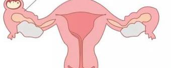 医生说我的子宫内膜只有6mm还能选择试管婴儿辅助生育吗