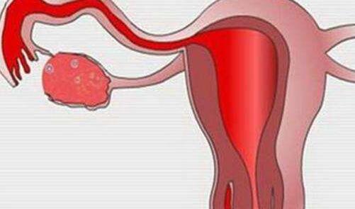 ѹܻˮӦô죬ҾҪԹӤ