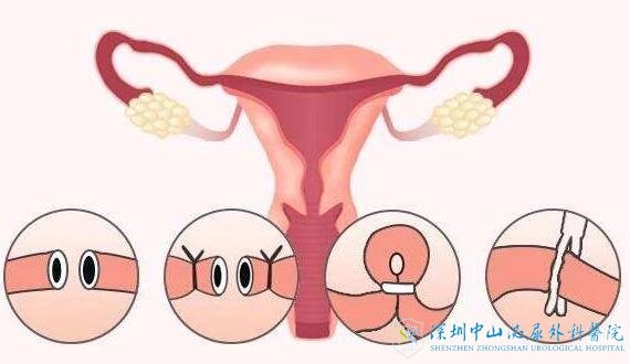 ѹܼճ30һܵɽҽԺԹӤ