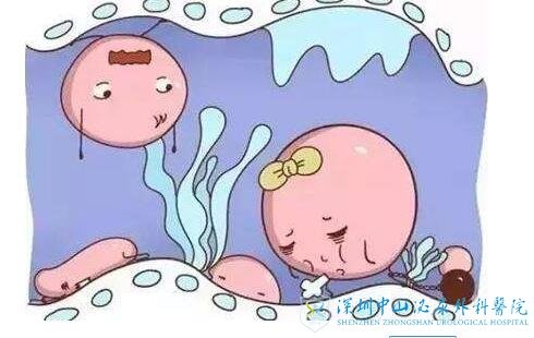 ҾҪԹӤֲˣѹлˮô