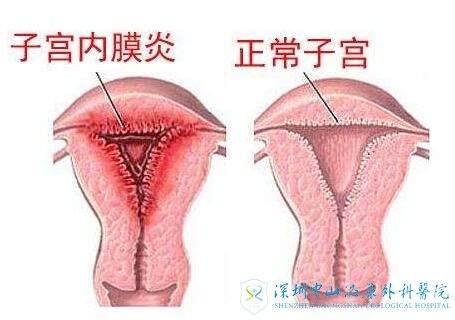 ˵ҵӹĤ̫Ӧô˳ԹӤ