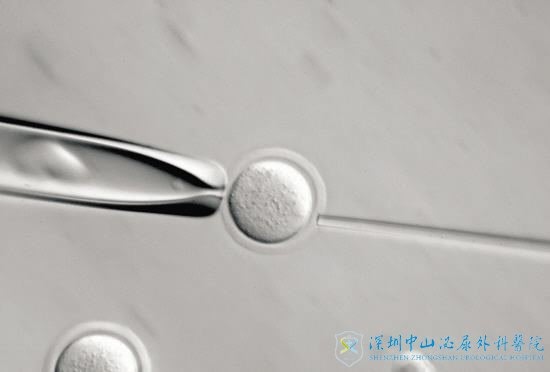 备孕两年了还是没有好孕,现在我选择试管婴儿辅助生育……