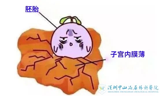 子宫内膜太薄了考虑试管婴儿会影响吗