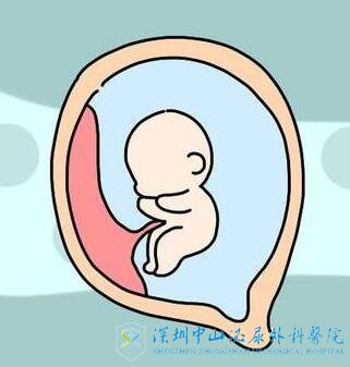 我选择了试管婴儿助孕就一定能怀上宝宝了吗?我需要先了解什么吗