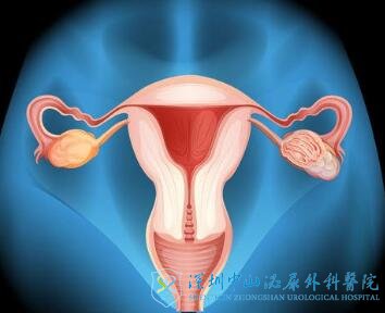 “不听话的内膜出走了”,难孕想去深圳中山生殖做试管需要怎么处理
