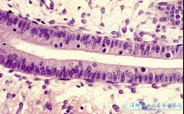 зȥɽֳԹܣҽҵӹĤ7mm᲻Ӱ찡