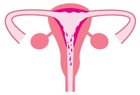 子宫内膜薄可以做试管婴儿吗