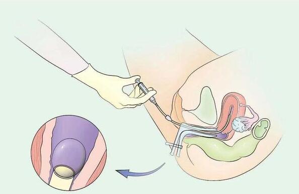 ŮԲȥһԹӤҪעʲô