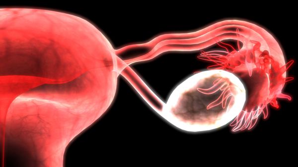 卵巢储备下降合并输卵管堵塞试管婴儿会宫外孕吗