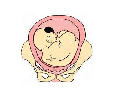 子宫内膜薄适合做试管婴儿吗