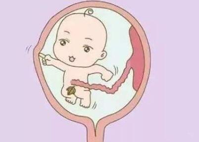 子宫腺肌症好发于哪个年龄段能不能试管婴儿